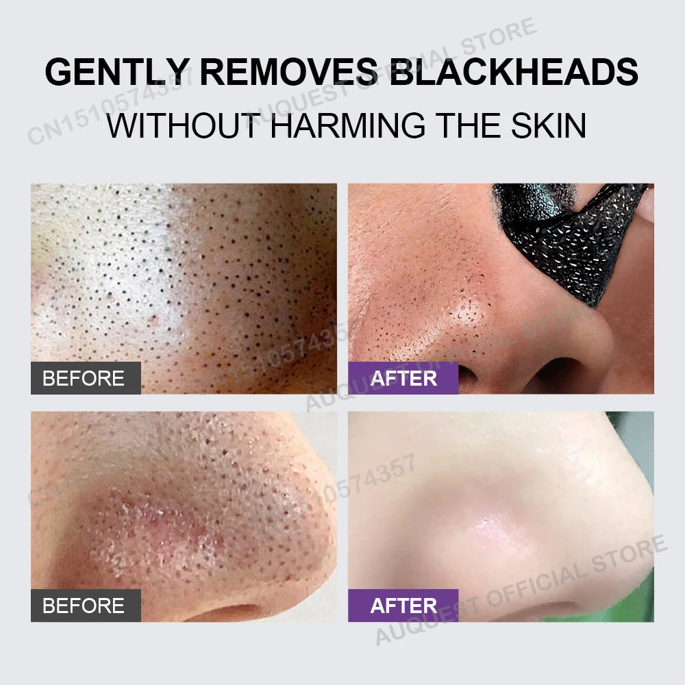 Blackhead Remover Face Mask Cream Oil-Control Nose Black Dots Mask Deep Cleansing Pore Nose Men Women Beauty Cosmetics Skin Care